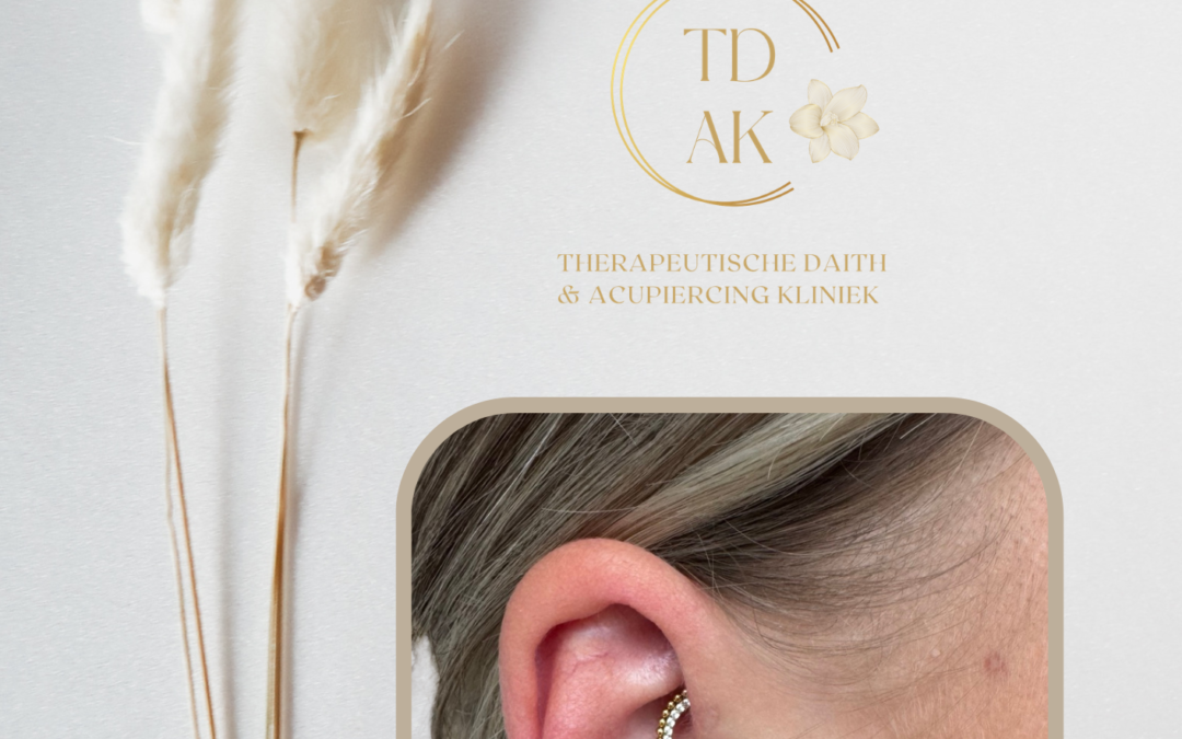 Kan een Daith piercing helpen bij het kalmeren van het zenuwstelsel?